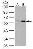 Anti-ATG14 antibody used in Western Blot (WB). GTX128166