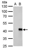 Anti-WIPI1 antibody used in Western Blot (WB). GTX128167