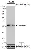 Anti-SQSTM1 / P62 antibody used in Western Blot (WB). GTX128173