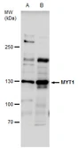 Anti-MYT1 antibody used in Western Blot (WB). GTX128188