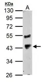 Anti-PRMT1 antibody used in Western Blot (WB). GTX128211