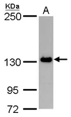 Anti-PPP1R3A antibody used in Western Blot (WB). GTX128215