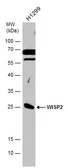 Anti-WISP2 antibody used in Western Blot (WB). GTX128233