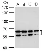 Anti-CDYL2 antibody used in Western Blot (WB). GTX128239