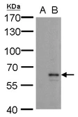 Anti-MMP24 antibody used in Western Blot (WB). GTX128246