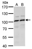 Anti-MYSM1 antibody used in Western Blot (WB). GTX128254