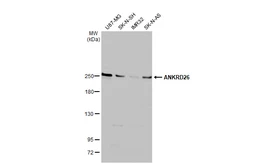 Anti-ANKRD26 antibody used in Western Blot (WB). GTX128255