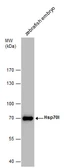 Anti-Hsp70l antibody used in Western Blot (WB). GTX128403