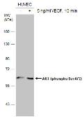 Anti-AKT (phospho Ser473) antibody used in Western Blot (WB). GTX128414