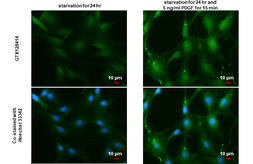 Anti-AKT (phospho Ser473) antibody used in Immunocytochemistry/ Immunofluorescence (ICC/IF). GTX128414