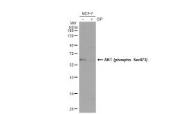 Anti-AKT (phospho Ser473) antibody used in Western Blot (WB). GTX128414