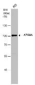 Anti-ATG9A antibody used in Western Blot (WB). GTX128427