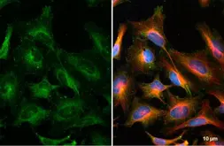 Anti-ATG9A antibody used in Immunocytochemistry/ Immunofluorescence (ICC/IF). GTX128427