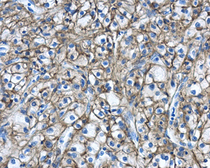 Anti-Carbonic Anhydrase IX antibody used in IHC (Paraffin sections) (IHC-P). GTX128428