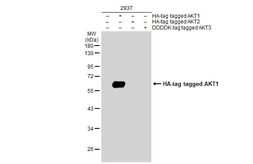 Anti-AKT1 antibody used in Western Blot (WB). GTX128456