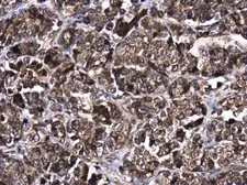 Anti-AKT2 antibody used in IHC (Paraffin sections) (IHC-P). GTX128458