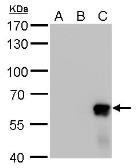 Anti-AKT2 antibody used in Western Blot (WB). GTX128458