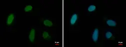 Anti-MRG15 antibody used in Immunocytochemistry/ Immunofluorescence (ICC/IF). GTX128495