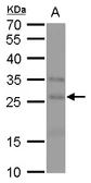 Anti-FGF18 antibody used in Western Blot (WB). GTX128496