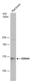 Anti-KDM4A antibody used in Western Blot (WB). GTX128497