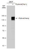 Anti-mCherry antibody used in Western Blot (WB). GTX128509