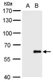 Anti-Influenza B virus antibody used in Western Blot (WB). GTX128544