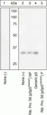 Anti-RPS6 (phospho Ser244/247) antibody used in Western Blot (WB). GTX12865