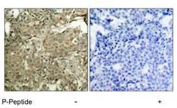 Anti-Cofilin 1 (phospho Ser3) antibody used in IHC (Paraffin sections) (IHC-P). GTX12866