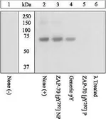 Anti-ZAP70 (phospho Tyr292) antibody used in Western Blot (WB). GTX12868