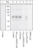 Anti-ZAP70 (phospho Tyr315/Tyr319) antibody used in Western Blot (WB). GTX12869