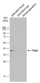 Anti-Olig2 antibody used in Western Blot (WB). GTX128699
