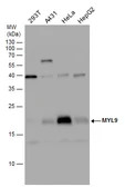 Anti-Myosin Light Chain 2 antibody used in Western Blot (WB). GTX128785