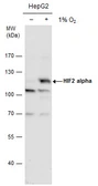 Anti-HIF2 alpha antibody used in Western Blot (WB). GTX128793