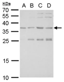 Anti-SLUG antibody used in Western Blot (WB). GTX128796