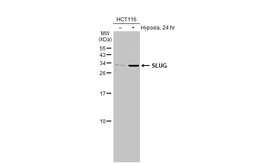 Anti-SLUG antibody used in Western Blot (WB). GTX128796