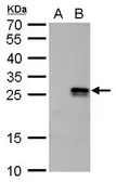 Anti-nm23-H6 antibody used in Western Blot (WB). GTX128818