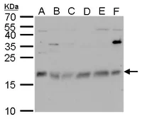 Anti-CHAC2 antibody used in Western Blot (WB). GTX128819