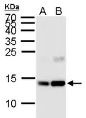 Anti-Histone H2AK5ac (acetyl Lys5) antibody used in Western Blot (WB). GTX128961