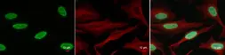 Anti-Histone H2BK20ac (acetyl Lys20) antibody used in Immunocytochemistry/ Immunofluorescence (ICC/IF). GTX128962
