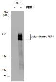 Anti-PER1 antibody used in Western Blot (WB). GTX128966