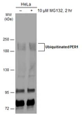 Anti-PER1 antibody used in Western Blot (WB). GTX128966