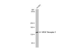 Anti-VEGF Receptor 1 antibody used in Western Blot (WB). GTX128969