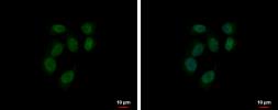Anti-RUVBL2 antibody used in Immunocytochemistry/ Immunofluorescence (ICC/IF). GTX128970