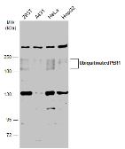 Anti-PER1 antibody used in Western Blot (WB). GTX128974