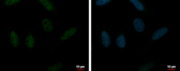 Anti-RUVBL2 antibody used in Immunocytochemistry/ Immunofluorescence (ICC/IF). GTX128975