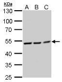 Anti-RUVBL2 antibody used in Western Blot (WB). GTX128975