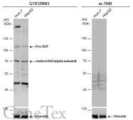 Anti-HGF (alpha subunit) antibody used in Western Blot (WB). GTX129003