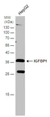 Anti-IGFBP1 antibody used in Western Blot (WB). GTX129006