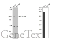 Anti-L1CAM antibody used in Western Blot (WB). GTX129010