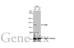 Anti-AHR antibody used in Western Blot (WB). GTX129013